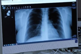 Afrika sıcaklarıyla akciğer ve alerji hastalıkları da arttı