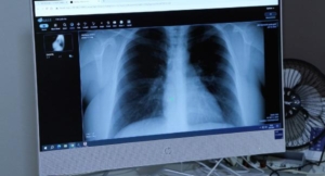 Afrika sıcaklarıyla akciğer ve alerji hastalıkları da arttı