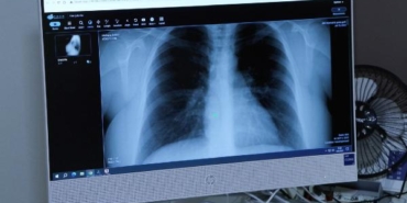 “Afrika sıcaklarıyla akciğer ve alerji hastalıkları da arttı” 15 Afrika sıcaklarıyla akciğer ve alerji hastalıkları da arttı