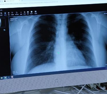 Afrika sıcaklarıyla akciğer ve alerji hastalıkları da arttı