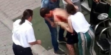 Apartman yöneticisi kavga ettiği anne ile oğlunu bıçakla yaraladı 23 Apartman yöneticisi kavga ettiği anne ile oğlunu bıçakla yaraladı