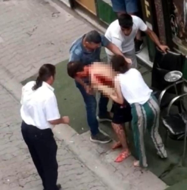 Apartman yöneticisi kavga ettiği anne ile oğlunu bıçakla yaraladı