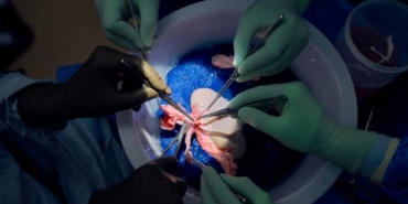 Domuz böbreği, 32 gün boyunca insan vücudunda işlevini yerine getirdi 40 Domuz böbreği 32 gün boyunca insan vücudunda işlevini yerine getirdi