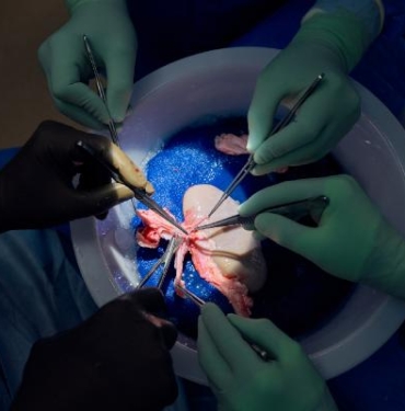 Domuz böbreği, 32 gün boyunca insan vücudunda işlevini yerine getirdi 2 Domuz böbreği 32 gün boyunca insan vücudunda işlevini yerine getirdi