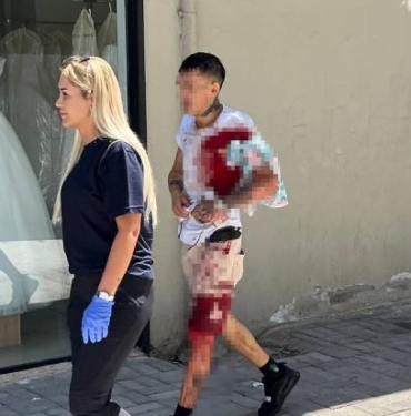 Eski sevgiliyle tamircinin kıskançlık kavgası 2 yaralı