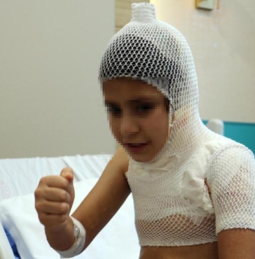 Fatma sosyal medyadaki kolonya yakma videosu nedeniyle canından oluyordu