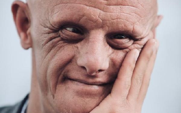 Hayatını kaybeden down sendromlu Habipin adı parka verilecek