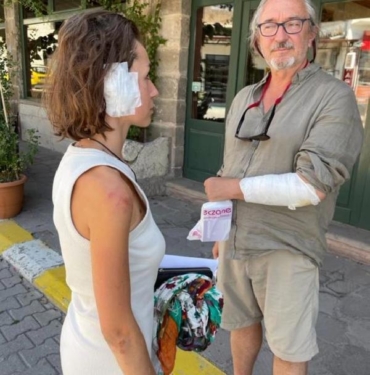 Nevşehir'de köpeklerin saldırısına uğrayan 2 turist yaralandı 3 Nevşehirde köpeklerin saldırısına uğrayan 2 turist yaralandı