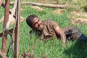 Şanlıurfada kuduz hastası hastaneden kaçtı vatandaşlar paniğe kapıldı