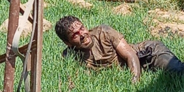 Şanlıurfada kuduz hastası hastaneden kaçtı vatandaşlar paniğe kapıldı