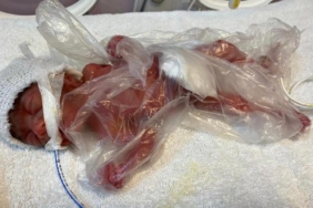 Zehra 211 günlük mücadelesinden zaferle çıktı