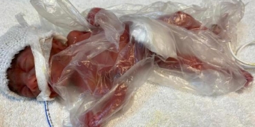 Zehra 211 günlük mücadelesinden zaferle çıktı