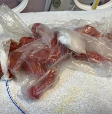 Zehra 211 günlük mücadelesinden zaferle çıktı