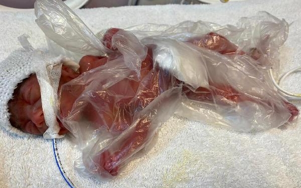 Zehra, 211 günlük mücadelesinden zaferle çıktı 1 Zehra 211 günlük mücadelesinden zaferle çıktı