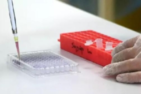 “Kanser cerrahisinde hedef, tekrarlama riskini yüzde 10’un altında tutmaktır” 