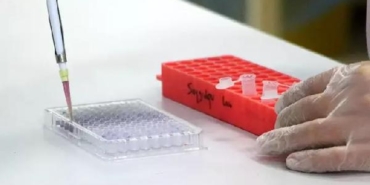 “Kanser cerrahisinde hedef, tekrarlama riskini yüzde 10’un altında tutmaktır” 10 “Kanser cerrahisinde hedef, tekrarlama riskini yüzde 10’un altında tutmaktır”